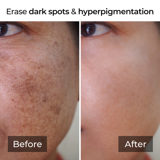 Kojic Acid Turmeric Collagen Overnight Mask