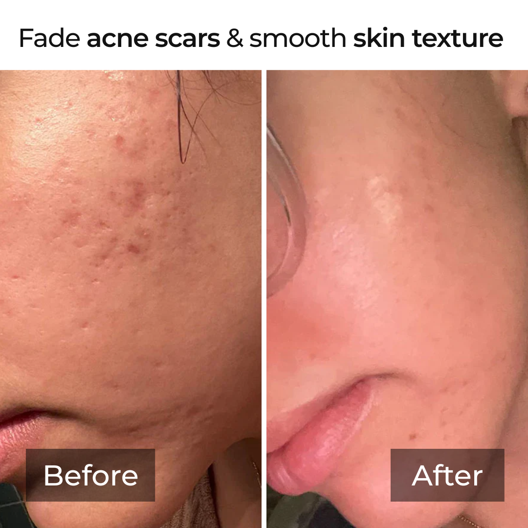 Kojic Acid Turmeric Collagen Overnight Mask